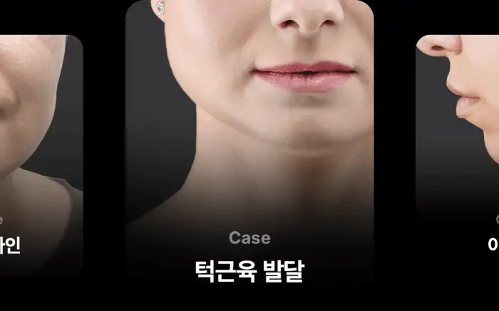 [이중턱/윤곽케어] 메디큐브 에이지알 부스터 브이롤러 헤드 (핑크/베이지) 상세페이지 18